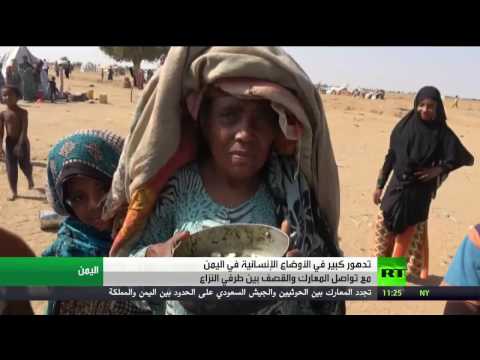 شاهد تدهور كبير في الأوضاع الإنسانية في اليمن