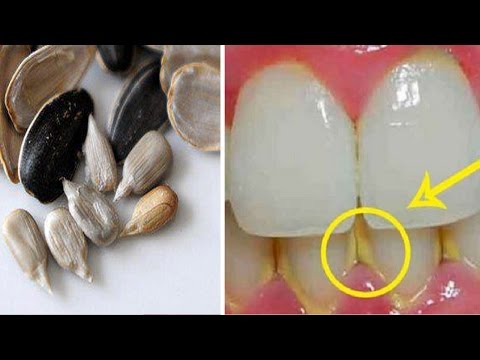 شاهد طريقة مدهشة للتخلّص من رواسب الأسنان