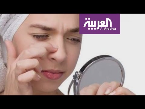 أفضل الطرق للتخلص من الرؤوس السوداء