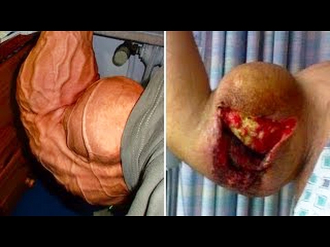 5 لاعبين كمال الأجسام انفجرت عضلاتهم بشكل مرعب