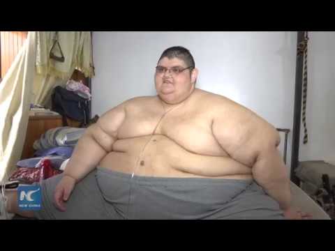 أسمن رجل فى العالم يخسر 218 كيلو غرام ويفقد رقمه القياسي
