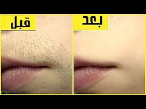 شاهد أسهل طريقة لإزالة شعر الوجه