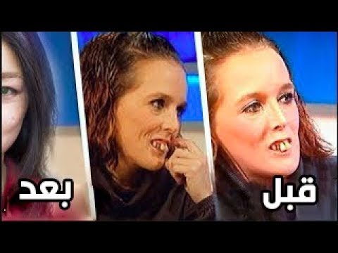 شاهد سخروا من شكلها القبيح فجعلتهم يندمون