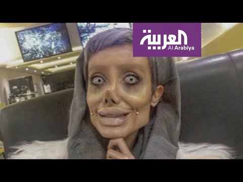 شاهد فتاة تُجري 50 عملية تجميل لتُشبه أنجلينا جولي