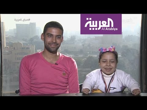 شاهد لقاء طريف مع طفلة مصرية تحدت الاعاقة