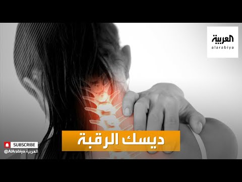 بالفيديو تعرّف على أعراض ديسك الرقبة