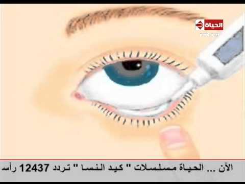 بالفيديو الطريقة المثلى لوضع قطرات ومراهم العين