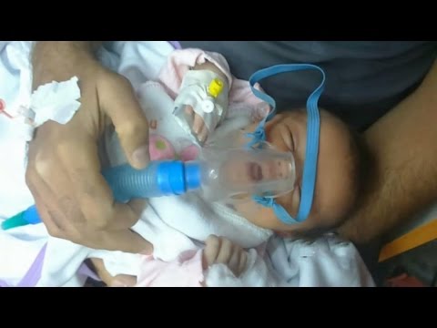 شاهد وفاة طفلة سورية بغازات داعش الكيماوية