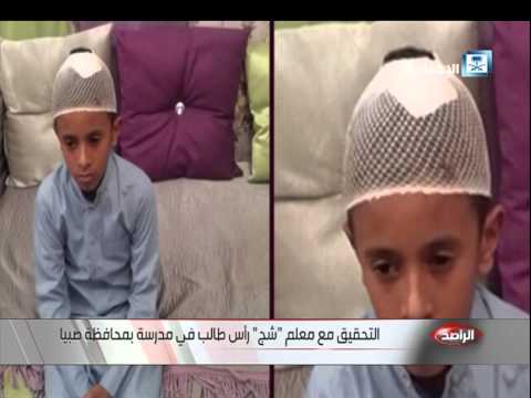 شاهد التحقيق مع المعلم شج رأس طالب في صبيا