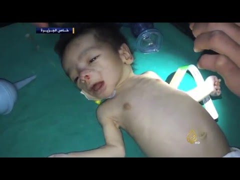 شاهد حصار التجويع يلتهم معضمية الشام