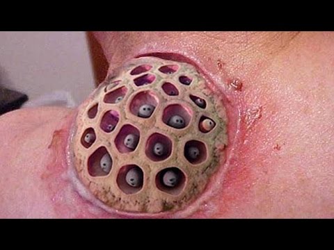 بالفيديو أغرب الأمراض التي صدمت المشاهدين