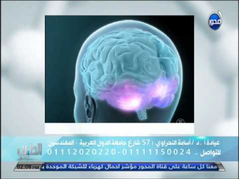 أسباب الإصابة بـالحول وطرق علاجه